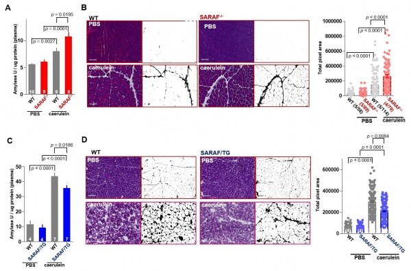 SARAF 유전자가 결여된 생쥐와 과발현된 생쥐에서의 급성 췌장염 정도 비교 (사진: 한국연구재단 제공)