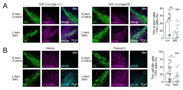 도파민 신경세포에서 오글루넥당화(O-GlcNAcylation)를 증가시켰을 때의 변화