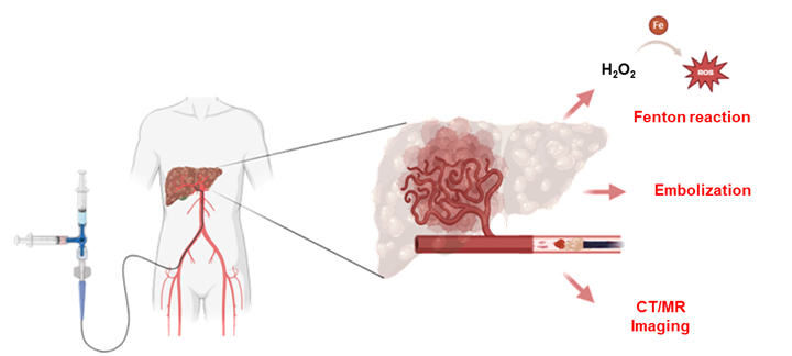 가톨릭대, ‘간암 색전용 주사형 하이...